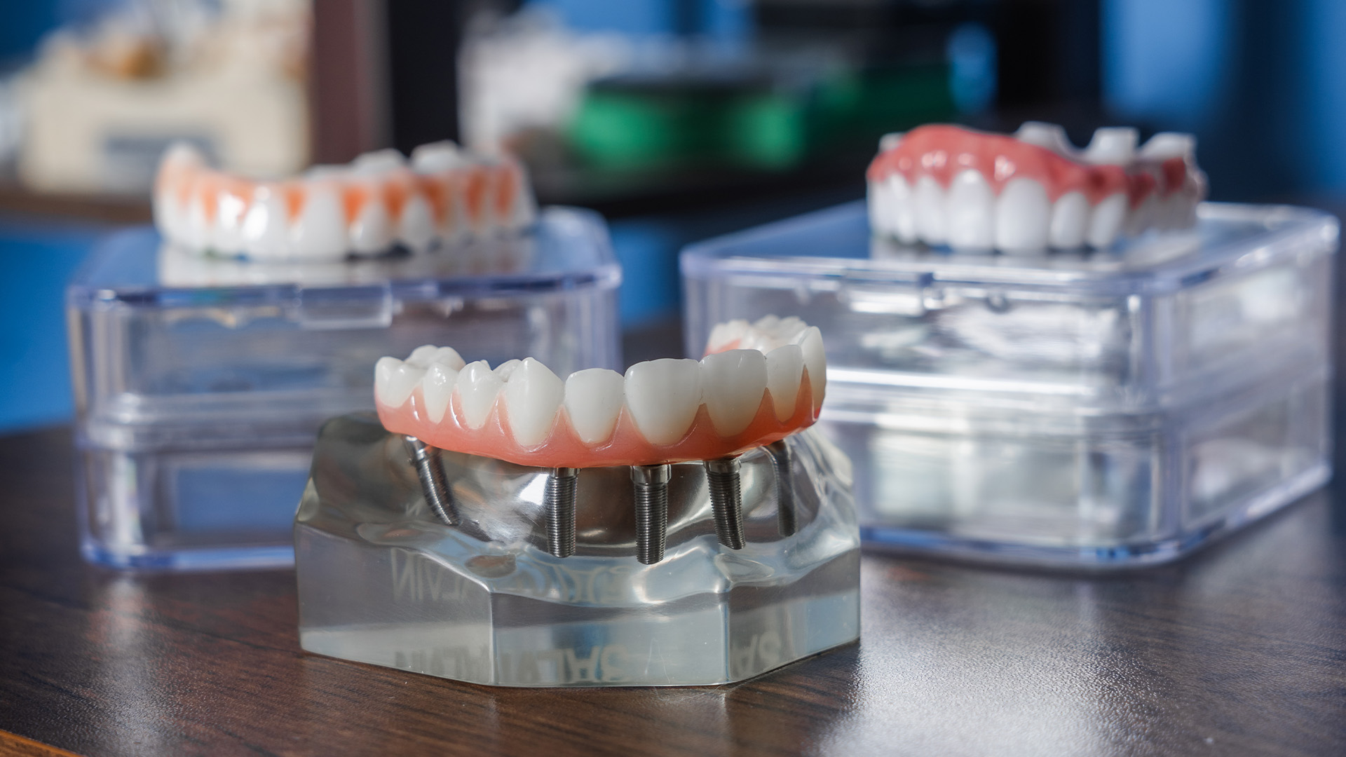 The Wobbly Tooth Dental Practice | Dental Lab, Full Mouth Reconstruction and CBCT